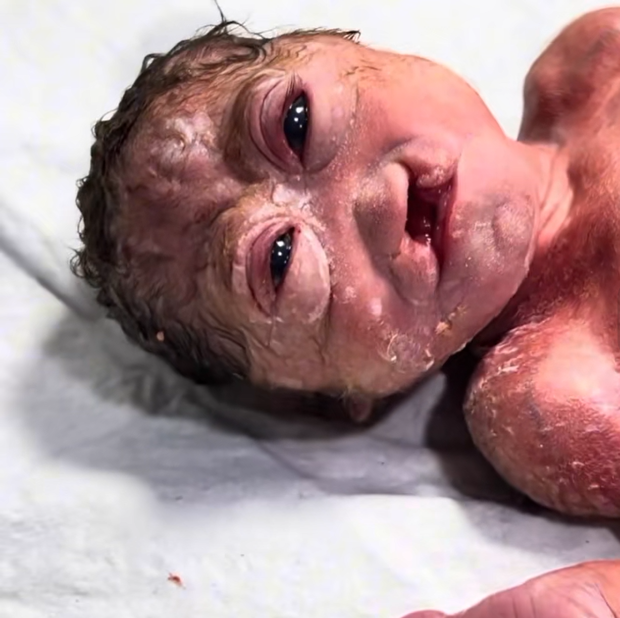 💙 A Fragile Beginning: Baby Asher’s Fight for Life