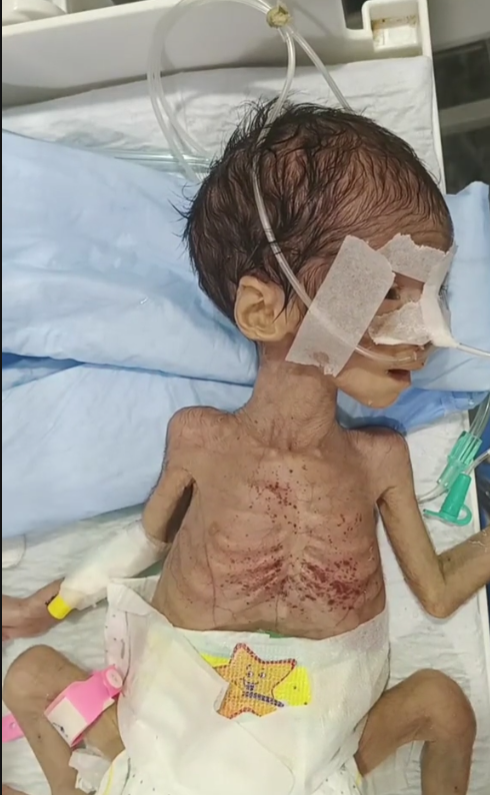 💔 A Fragile Little Fighter: Baby Anna’s Story