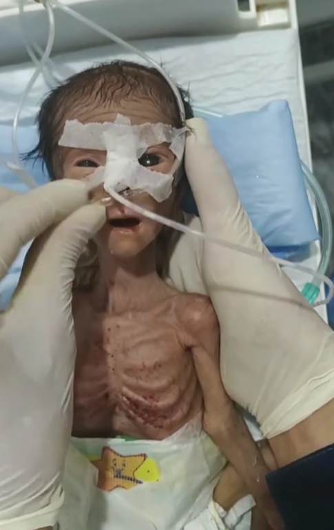 💔 A Fragile Little Fighter: Baby Anna’s Story