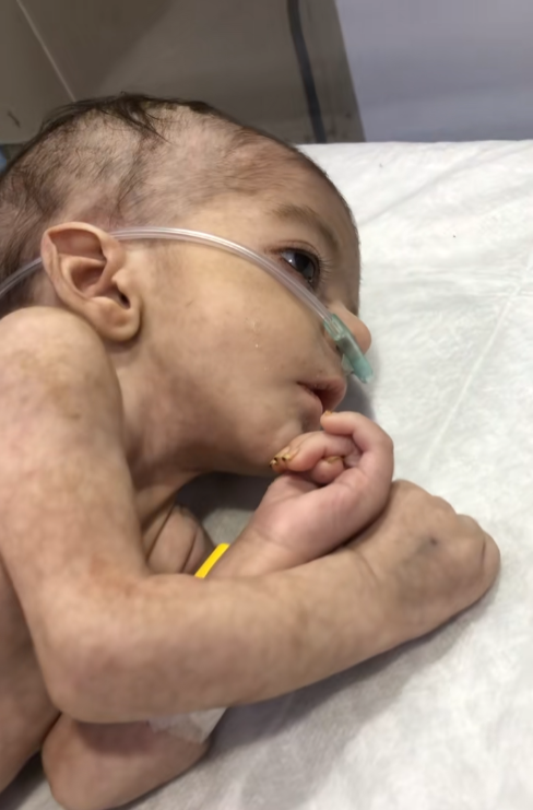 Help Baby Carter Survive: A Fragile Life Fighting Again