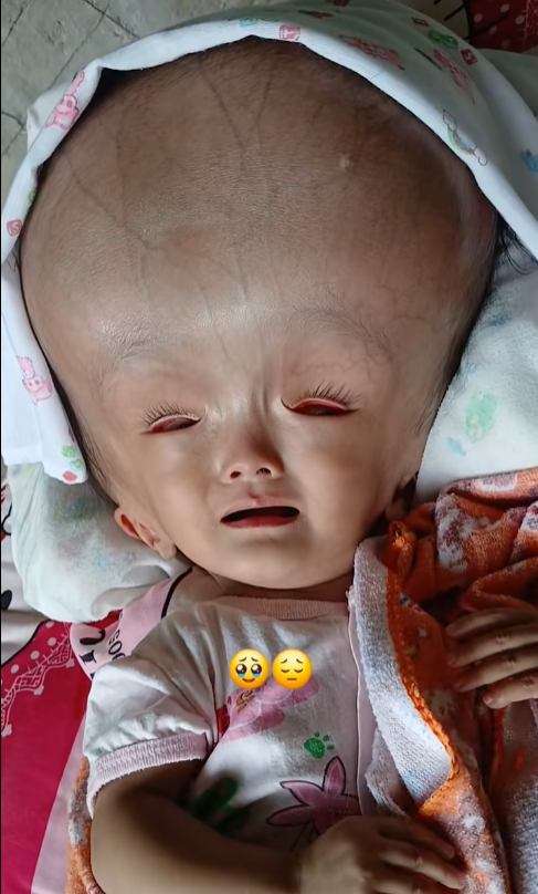 A Tiny Heart Carrying the Weight of the World